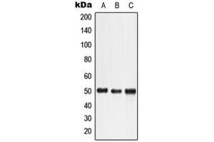 Western blot analysis of LTBR expression in HeLa (A), HuT78 (B), K562 (C) whole cell lysates. (LTBR 抗体  (N-Term))