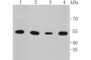 Lane 1: A549 Cell lysates, Lane 2: HepG2 Cell lysates, Lane 3: SK-BR-3 Cell lysates, Lane 4: SW1990 cell lysates, probed with Cytokeratin 7 (6E6) Monoclonal Antibody  at 1:1000 overnight at 4˚C. (Cytokeratin 7 抗体)