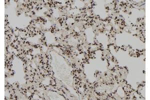ABIN6272384 at 1/100 staining Rat lung tissue by IHC-P. (PEG3 抗体)