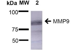 Western Blot analysis of Rat Brain showing detection of ~92 kDa and ~82 kDa (pro and active) MMP9 protein using Mouse Anti-MMP9 Monoclonal Antibody, Clone S51-82 . (MMP 9 抗体  (AA 1-708) (APC))