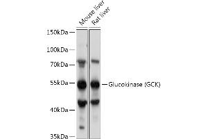 Western blot analysis of extracts of various cell lines, using Glucokinase (GCK) antibody (ABIN7267397) at 1:1000 dilution. (GCK 抗体  (AA 250-465))