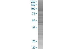 RBM39 transfected lysate. (RBM39 293T Cell Transient Overexpression Lysate(Denatured))