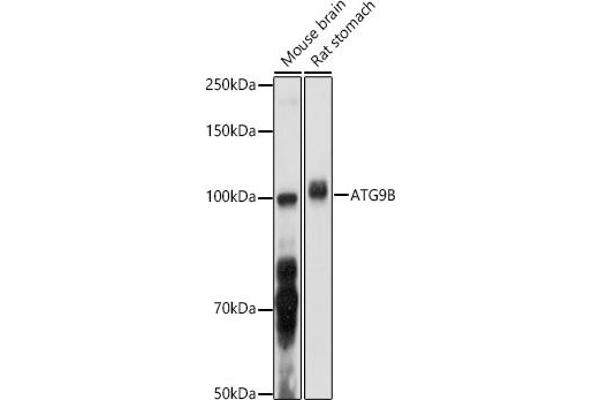 ATG9B 抗体  (AA 715-924)