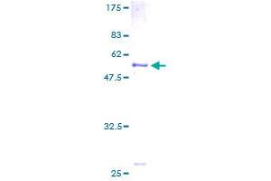 SLC25A20 Protein (AA 1-301) (GST tag)