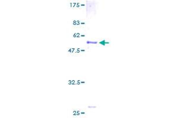 SLC25A20 Protein (AA 1-301) (GST tag)