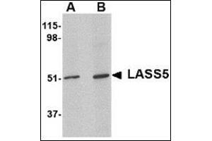 Western blot analysis of LASS5 in SK-N-SH lysate with this product at (A) 1 and (B) 2 μg/ml. (LASS5 抗体  (N-Term))