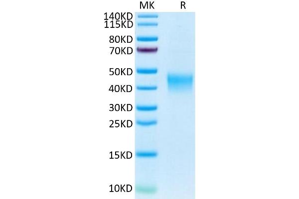 CRLF2 Protein (AA 25-231) (His tag)