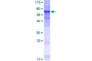 Image no. 1 for Ectonucleoside Triphosphate diphosphohydrolase 8 (ENTPD8) (AA 1-458) protein (GST tag) (ABIN1352857) (ENTPD8 Protein (AA 1-458) (GST tag))