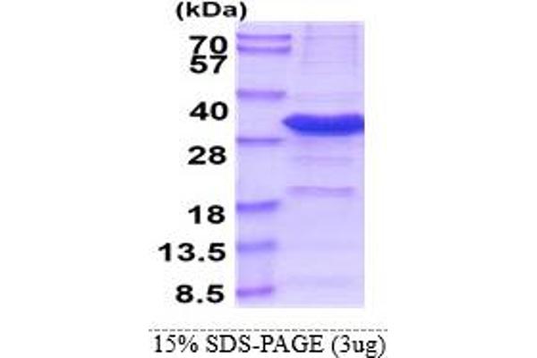 IYD Protein (AA 24-214) (His tag)