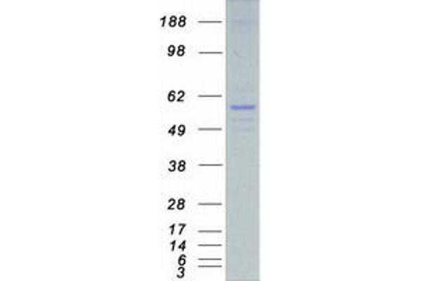 STK38L Protein (Myc-DYKDDDDK Tag)