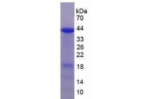 SDS-PAGE analysis of Human UBE3A Protein. (ube3a 蛋白)