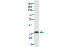 PDCD1LG2 monoclonal antibody (M46), clone 4G7. (PDCD1LG2 抗体  (AA 19-121))