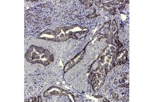 Immunohistochemistry (IHC) image for anti-CD44v5 antibody (ABIN2480453) (CD44v5 抗体)