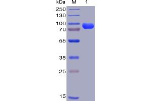 Human CD38, hFc-His Tag on SDS-PAGE under reducing condition. (CD38 Protein (AA 43-300) (Fc-His Tag))