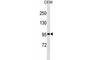 Western Blotting (WB) image for anti-Ubiquitin Specific Peptidase 1 (USP1) antibody (ABIN2999061) (USP1 抗体)