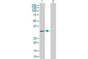 Lane 1: HIST1H1A transfected lysate ( 21. (HIST1H1A 293T Cell Transient Overexpression Lysate(Denatured))