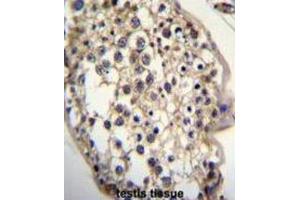 Immunohistochemistry (IHC) image for anti-7-Dehydrocholesterol Reductase (DHCR7) antibody (ABIN2996203) (DHCR7 抗体)