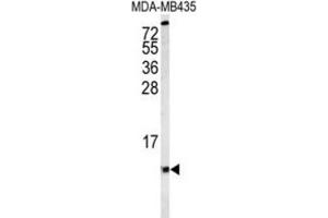 Western Blotting (WB) image for anti-Cytochrome C Oxidase Subunit VIa Polypeptide 1 (COX6A1) antibody (ABIN3004056) (COX6A1 抗体)