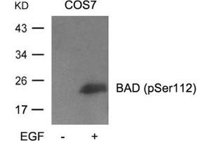 Western blot analysis of extracts from cos7 cells untreated or treated with EGF using BAD(Phospho-Ser112) Antibody (BAD 抗体  (pSer112))