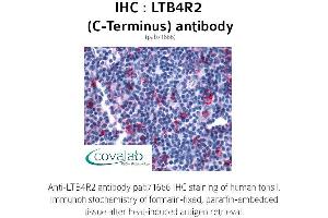 Image no. 1 for anti-Leukotriene B4 Receptor 2 (LTB4R2) (C-Term) antibody (ABIN1736595) (LTB4R2 抗体  (C-Term))