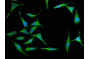 Immunofluorescence staining of Hela cells with ABIN7156645 at 1:100, counter-stained with DAPI. (MX2 抗体  (AA 548-688))