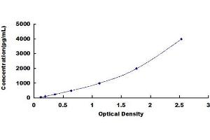 ELISA image for Cardiac Troponin T (cTnT) ELISA Kit (ABIN4948102) (Cardiac Troponin T2 ELISA 试剂盒)