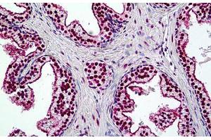 Human Prostate: Formalin-Fixed, Paraffin-Embedded (FFPE) (SMARCA4 抗体  (AA 2-14))