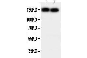 Anti-N Cadherin antibody, Western blotting Lane 1: MCF-7 Cell Lysate Lane 2: HELA Cell Lysate (N-Cadherin 抗体  (Middle Region))