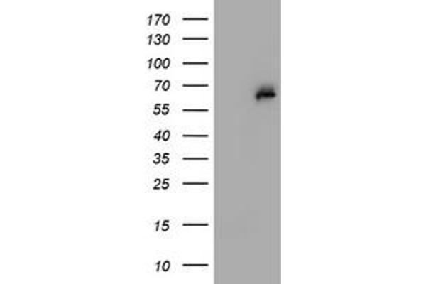 Phosphoglucomutase 3 抗体