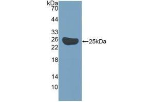 Detection of Recombinant Surv, Mouse using Polyclonal Antibody to Survivin (Surv) (Survivin 抗体  (AA 1-140))