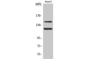 Western Blotting (WB) image for anti-Mast/stem Cell Growth Factor Receptor (KIT) (pTyr721) antibody (ABIN3179415) (KIT 抗体  (pTyr721))