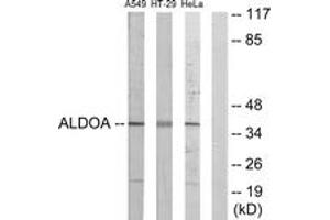 Western Blotting (WB) image for anti-Aldolase A, Fructose-Bisphosphate (ALDOA) (AA 1-50) antibody (ABIN2889376) (ALDOA 抗体  (AA 1-50))