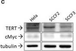 Western Blotting (WB) image for anti-Telomerase Reverse Transcriptase (TERT) (C-Term) antibody (ABIN6655270)