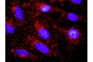 Proximity Ligation Analysis of protein-protein interactions between CTNNA3 and CTNNB1. (CTNNA3 抗体  (AA 1-516))