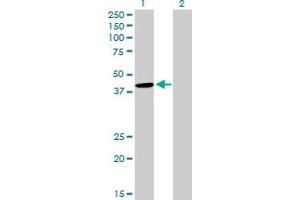 Western Blot analysis of CYTH2 expression in transfected 293T cell line by CYTH2 MaxPab polyclonal antibody. (Cytohesin 2 抗体  (AA 1-400))