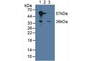 Western blot analysis of (1) Mouse Liver Tissue, (2) Mouse Brain Tissue and (3) Mouse Kidney Tissue. (Monoamine Oxidase B 抗体  (AA 206-505))