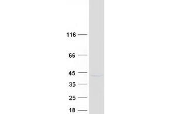 SLAMF9 Protein (Myc-DYKDDDDK Tag)