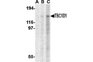 Western Blotting (WB) image for anti-TBC1 (Tre-2/USP6, BUB2, Cdc16) Domain Family, Member 1 (TBC1D1) (C-Term) antibody (ABIN1030722) (TBC1D1 抗体  (C-Term))