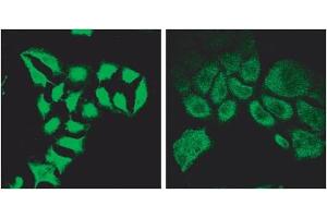 Immunofluorescence (2μg/ml) staining of methanol-fixed HeLa before (left) and after (right) introduction of siRNA. (SPG20 抗体  (Internal Region))