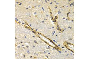 Immunohistochemistry of paraffin-embedded rat brain using KLKB1 antibody (ABIN2975433) at dilution of 1/200 (40x lens). (KLKB1 抗体)