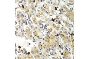 Immunohistochemistry of paraffin-embedded human stomach using MMP9 antibody (ABIN5971121) at dilution of 1/100 (40x lens). (MMP 9 抗体)