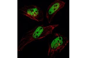 Fluorescent image of Hela cell stained with SUMO1 Antibody (N-term E67) (ABIN1882137 and ABIN2845494)/SH030609A. (SUMO1 抗体  (N-Term))