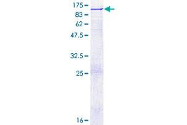 OS9 Protein (AA 1-612) (GST tag)