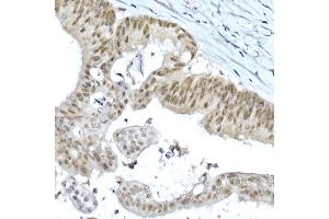 Immunohistochemistry of paraffin-embedded rat ovary using LGR5/GPR49 Rabbit pAb  at dilution of 1:300 (40x lens). (LGR5 抗体  (AA 824-907))