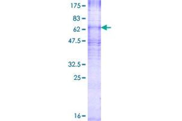 CDS2 Protein (AA 1-445) (GST tag)