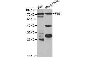 Western blot analysis of extracts of various cell lines, using F10 antibody (ABIN5970678) at 1/1000 dilution. (Coagulation Factor X 抗体)