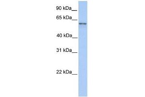 FAM13C1 antibody used at 1 ug/ml to detect target protein. (FAM13C 抗体  (N-Term))