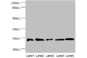 Western blot All lanes: Gstp1 antibody at 2 μg/mL Lane 1: Mouse kidney tissue Lane 2: Jurkat whole cell lysate Lane 3: K562 whole cell lysate Lane 4: 293T whole cell lysate Lane 5: Hela whole cell lysate Secondary Goat polyclonal to rabbit IgG at 1/10000 dilution Predicted band size: 24 kDa Observed band size: 24 kDa (GSTP1 抗体  (AA 2-210))