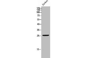 Western Blot analysis of JK cells using Phospho-Bcl-2 (S70) Polyclonal Antibody (Bcl-2 抗体  (pSer70))