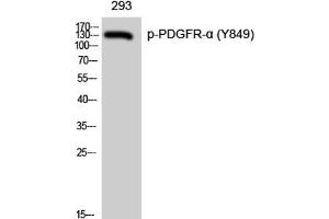 Western Blot analysis of 293 cells with Phospho-PDGFRA (Tyr849) Polyclonal Antibody (PDGFRA 抗体  (pTyr849))